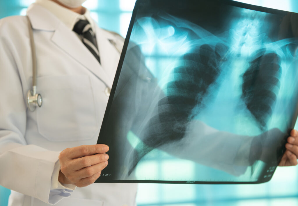 Doktor sieht sich ein Röntgenbild an