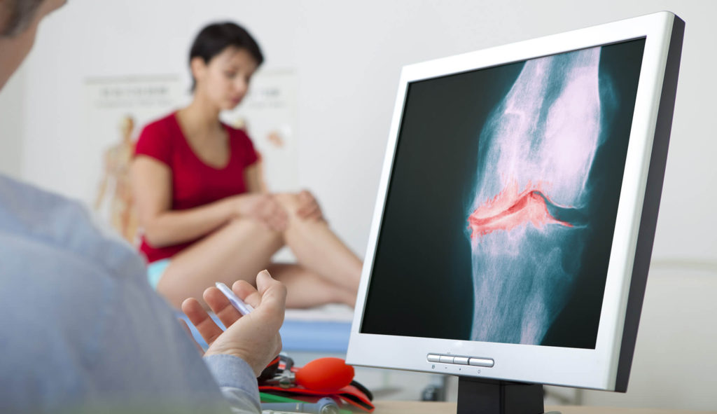 Arthrose Therapie